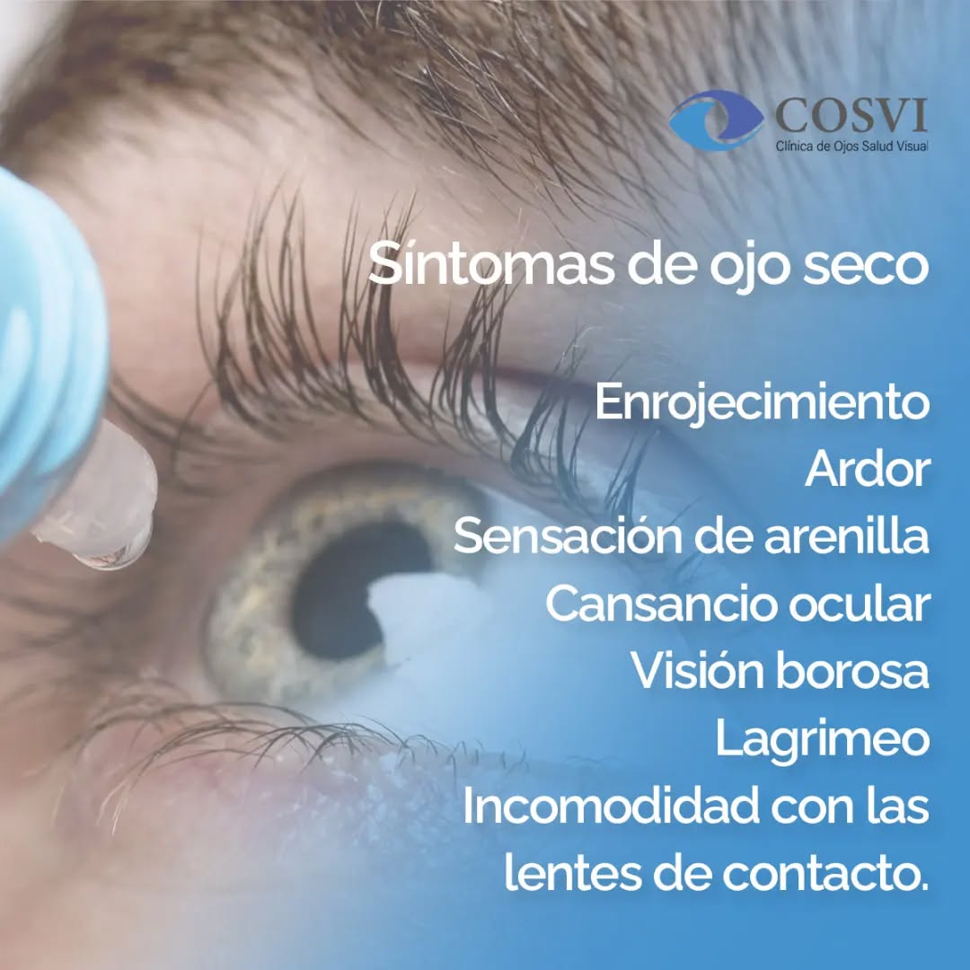 Síntomas del Ojo Seco